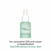 produs concentrat sos anti imperfectiuni sos anti blemish dalton derma control